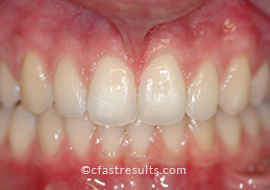 Case 24 after