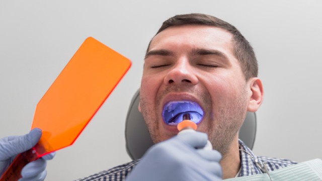 enamel erosion